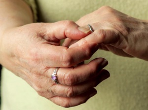 osteoarthritis_300